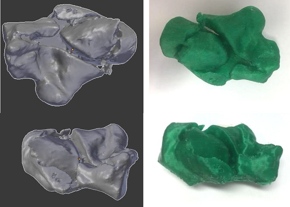 3D printed bones, Leapfrog, Mackay hospital, surgery simulation, Bolt Pro 3D printer